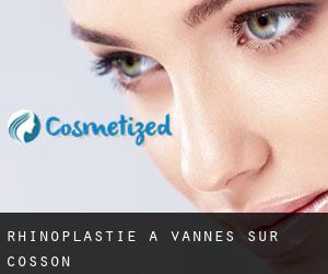 Rhinoplastie à Vannes-sur-Cosson