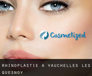 Rhinoplastie à Vauchelles-les-Quesnoy