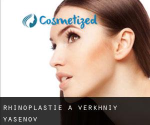 Rhinoplastie à Verkhniy Yasenov