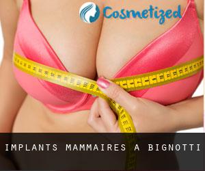 Implants mammaires à Bignotti