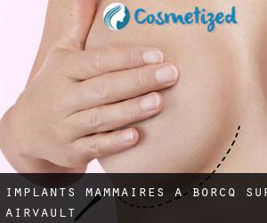 Implants mammaires à Borcq-sur-Airvault