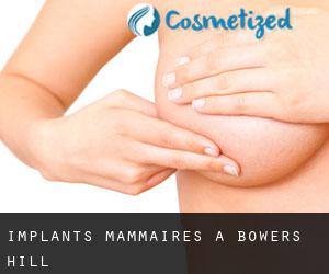Implants mammaires à Bowers Hill