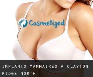 Implants mammaires à Clayton Ridge North