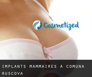 Implants mammaires à Comuna Ruşcova