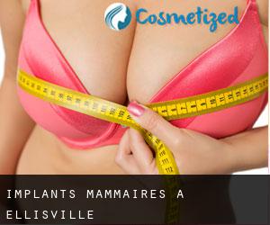 Implants mammaires à Ellisville