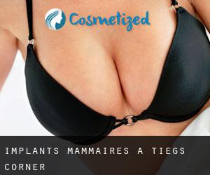 Implants mammaires à Tiegs Corner