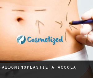 Abdominoplastie à Accola