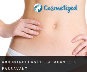 Abdominoplastie à Adam-lès-Passavant