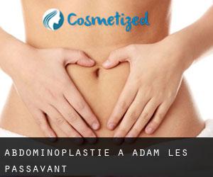 Abdominoplastie à Adam-lès-Passavant