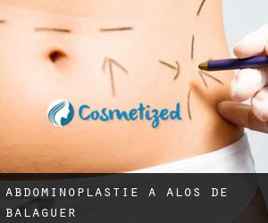 Abdominoplastie à Alòs de Balaguer