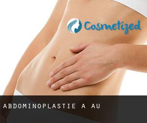 Abdominoplastie à Au