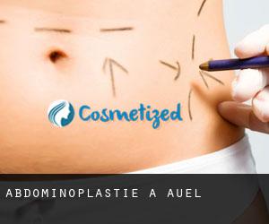 Abdominoplastie à Auel