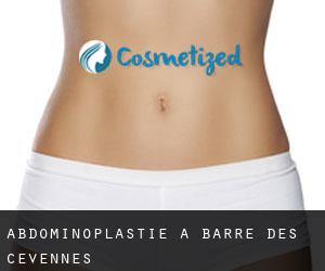 Abdominoplastie à Barre-des-Cévennes