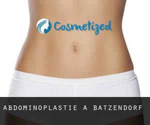 Abdominoplastie à Batzendorf