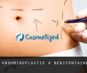 Abdominoplastie à Bénifontaine