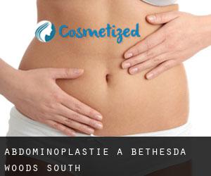 Abdominoplastie à Bethesda Woods South