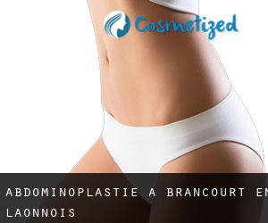 Abdominoplastie à Brancourt-en-Laonnois