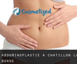 Abdominoplastie à Châtillon-la-Borde