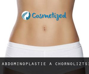 Abdominoplastie à Chornoliztsi