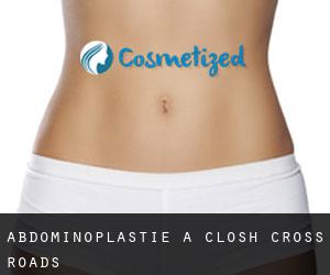 Abdominoplastie à Closh Cross Roads