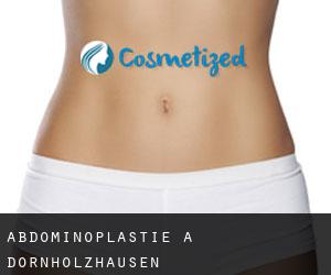 Abdominoplastie à Dornholzhausen