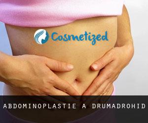 Abdominoplastie à Drumadrohid