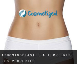 Abdominoplastie à Ferrières-les-Verreries