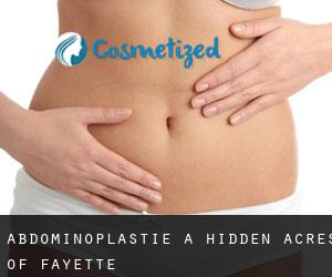 Abdominoplastie à Hidden Acres of Fayette