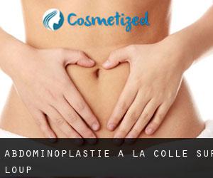 Abdominoplastie à La Colle-sur-Loup