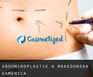 Abdominoplastie à Makedonska Kamenica