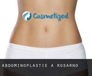 Abdominoplastie à Rosarno