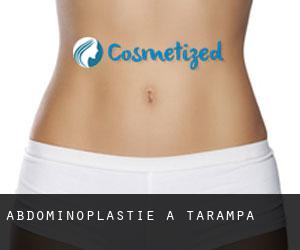 Abdominoplastie à Tarampa