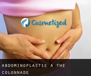 Abdominoplastie à The Colonnade