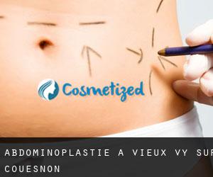 Abdominoplastie à Vieux-Vy-sur-Couesnon