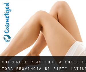 chirurgie plastique à Colle di Tora (Provincia di Rieti, Latium)