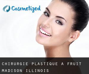 chirurgie plastique à Fruit (Madison, Illinois)
