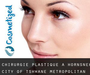 chirurgie plastique à Hornsnek (City of Tshwane Metropolitan Municipality, Gauteng)